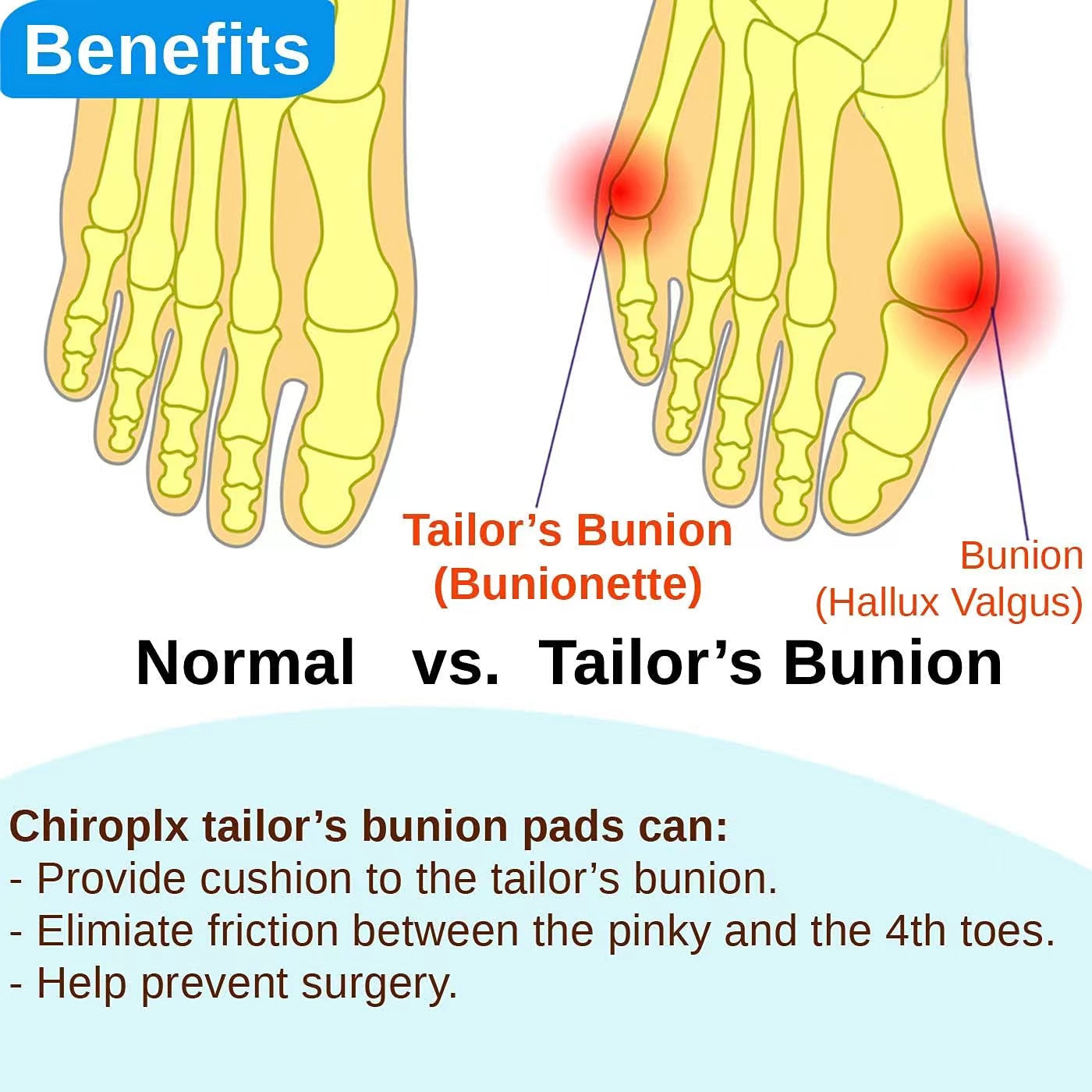 Tailor's Bunion Corrector Pads