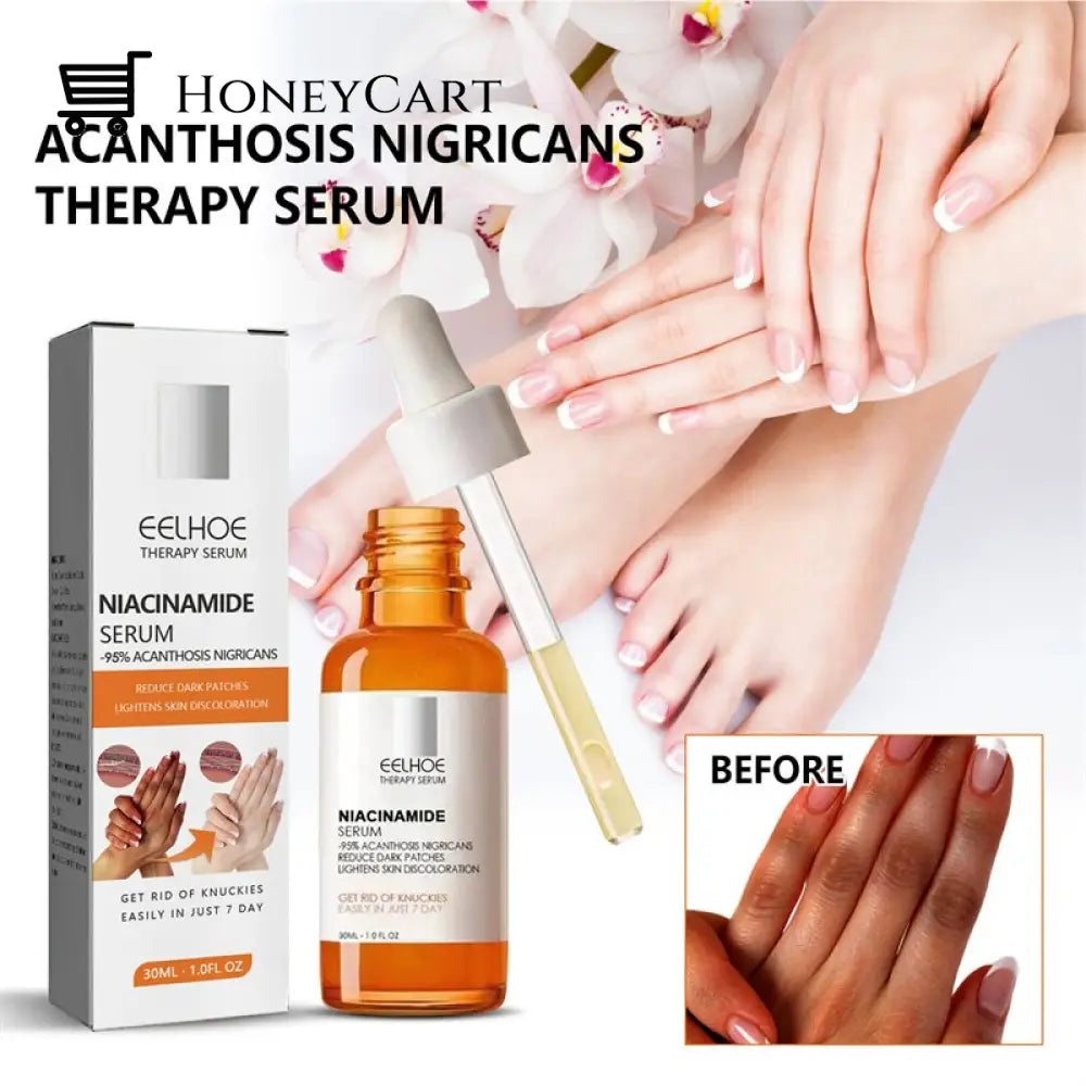 Advanced Skin Brightening Serum For Melanosis Dark Spot Removal