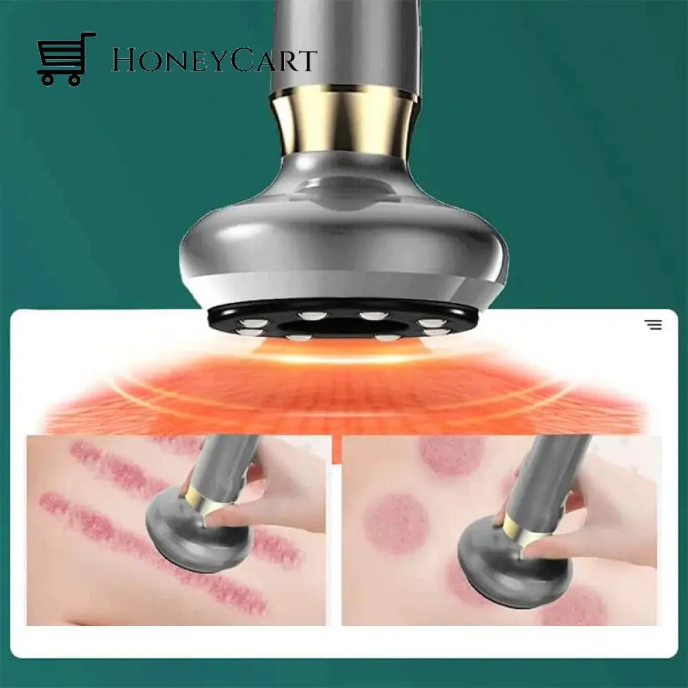 Fasicapro - Cupping Therapy Device Tops