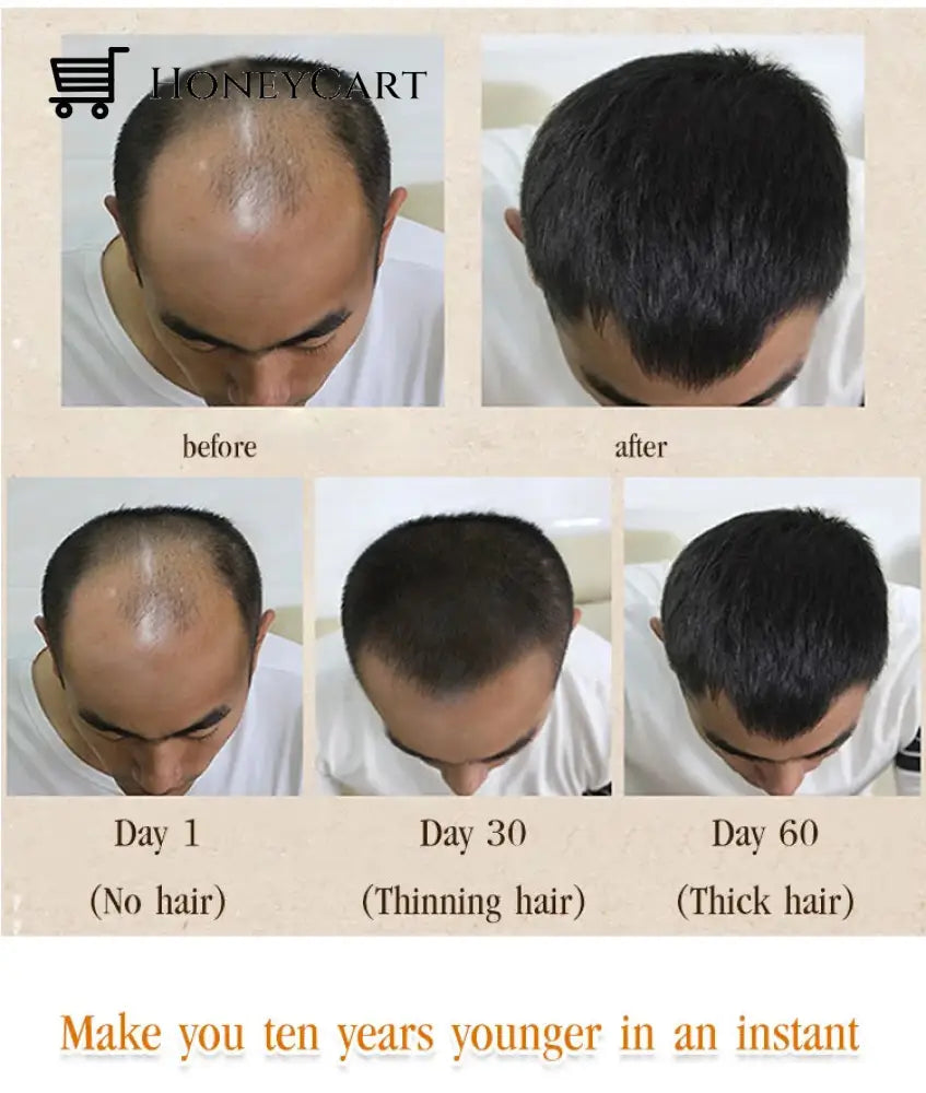 Hair Growth Essential Oil Health & Beauty