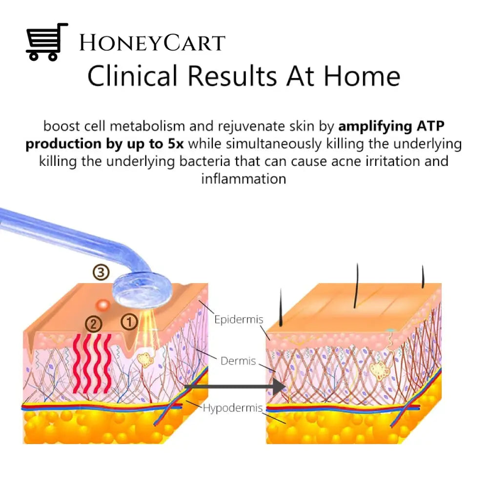 Ne+Ar High Frequency Facial Machine Electrotherapy Wands Wrinkles Remover Cleansing Kits