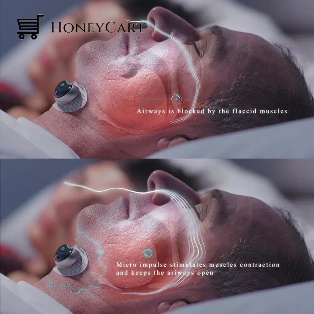 Smart Snoring Solution