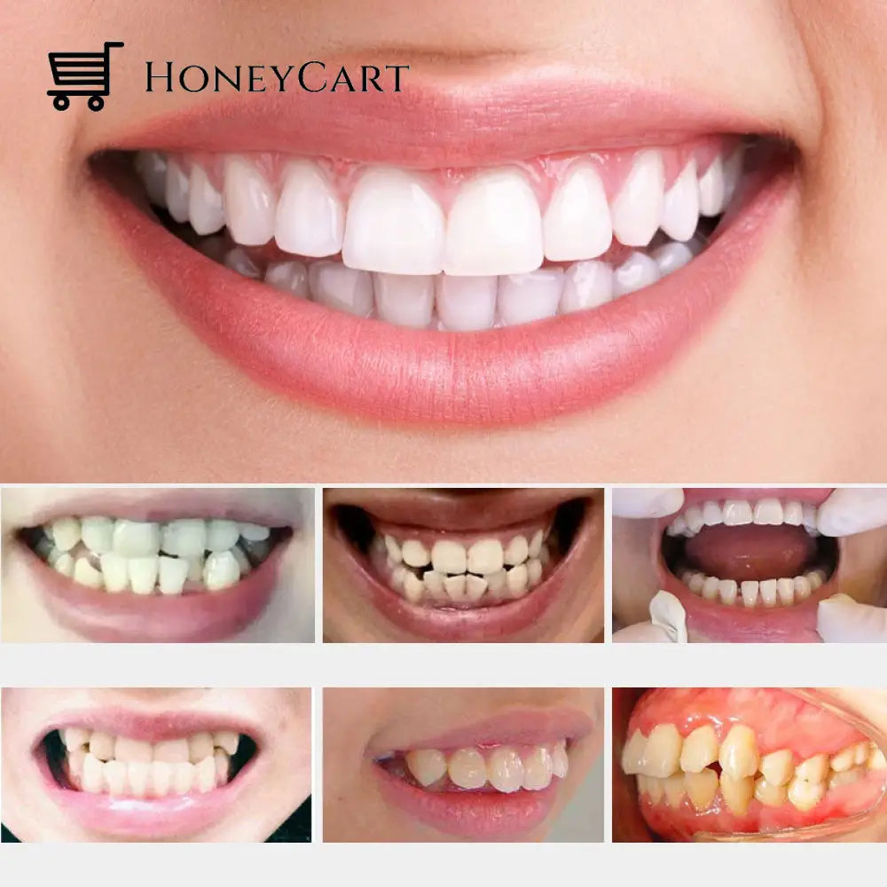 Tooth Orthodontic Braces