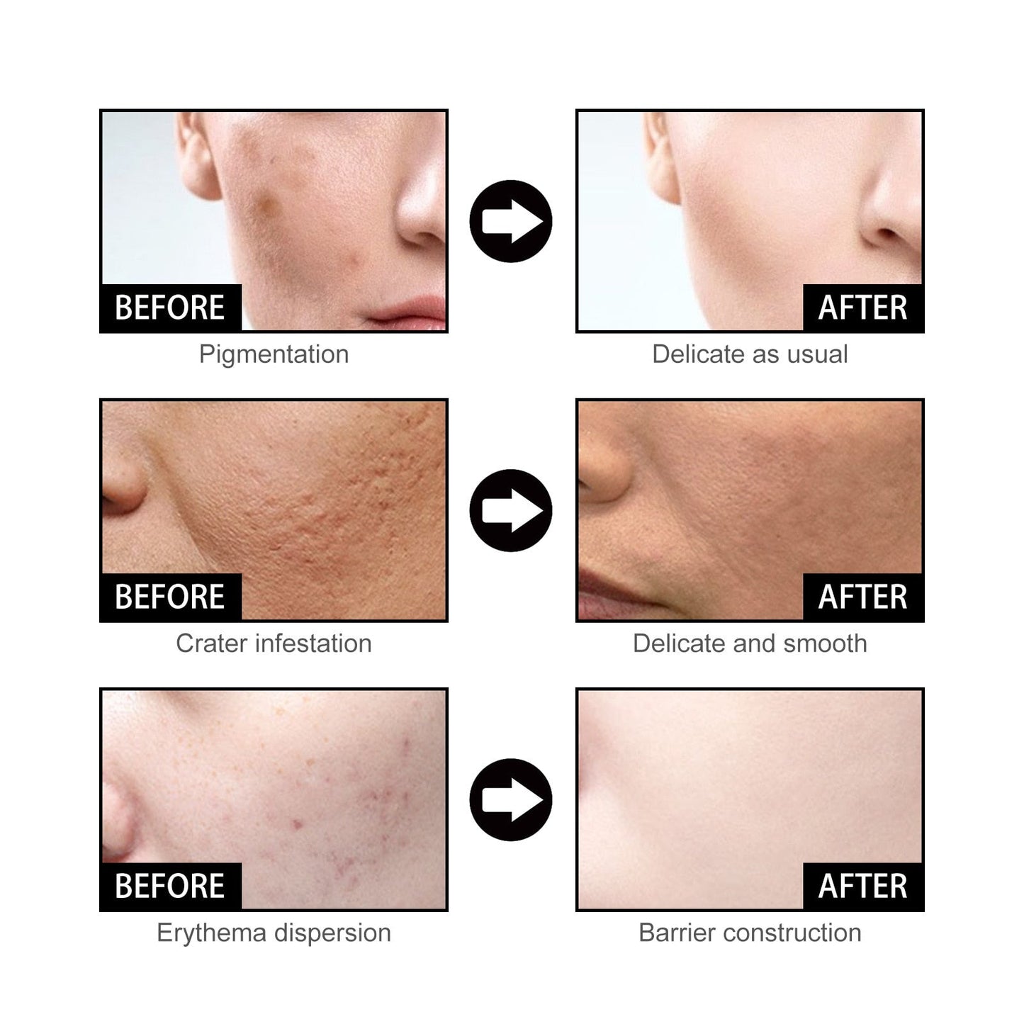 Niacinamide Facial Essence