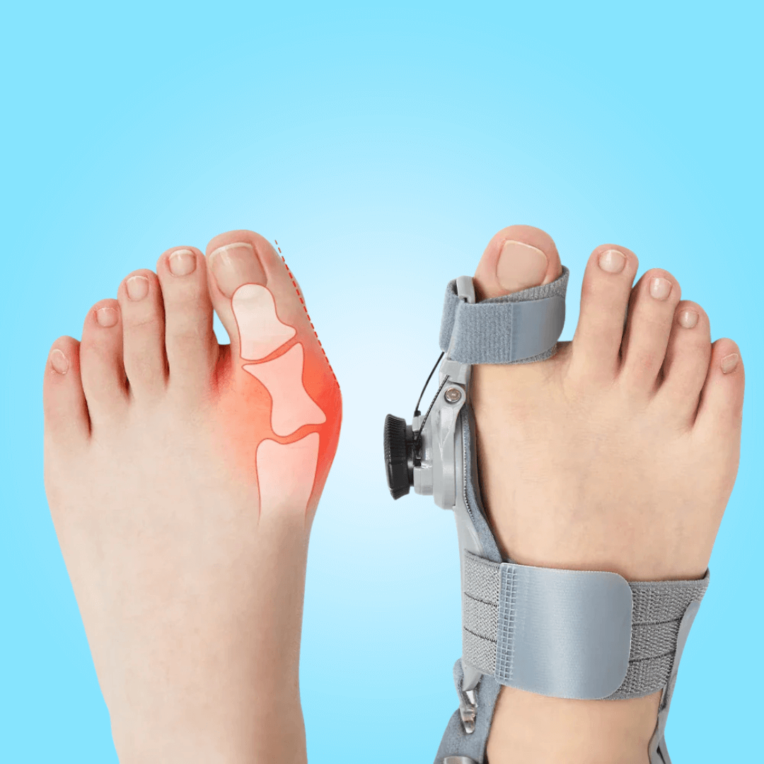 BunionFix™️ - Natural Bunion Corrector