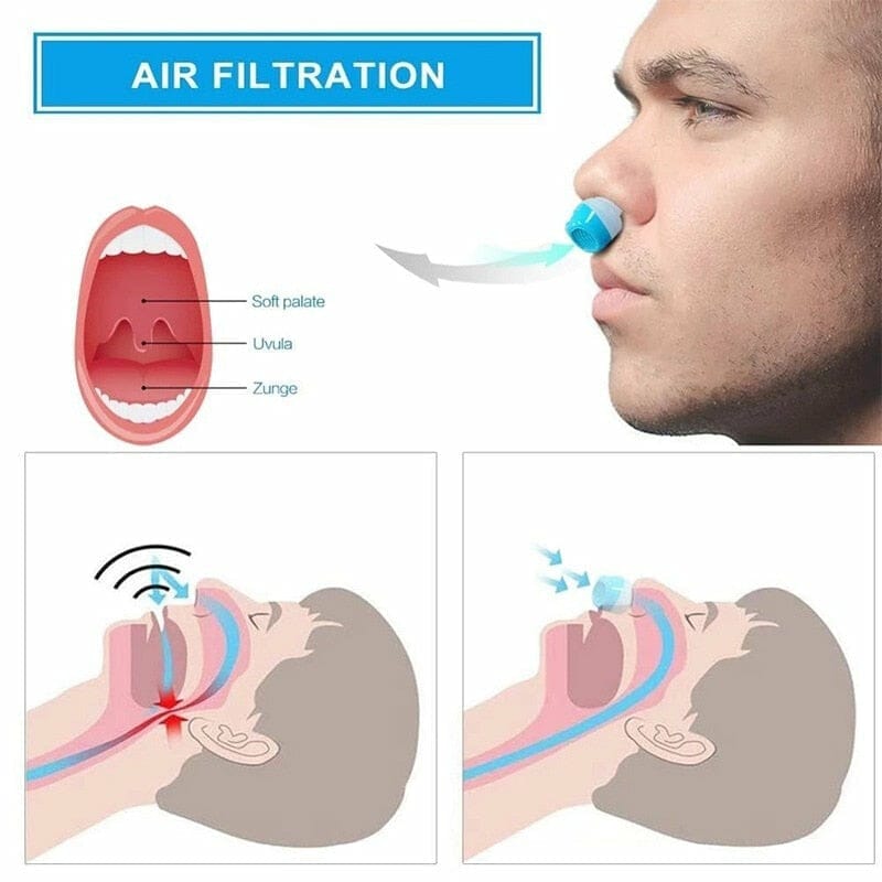 CRALYOON MICRO-CPAP ANTI SNORING