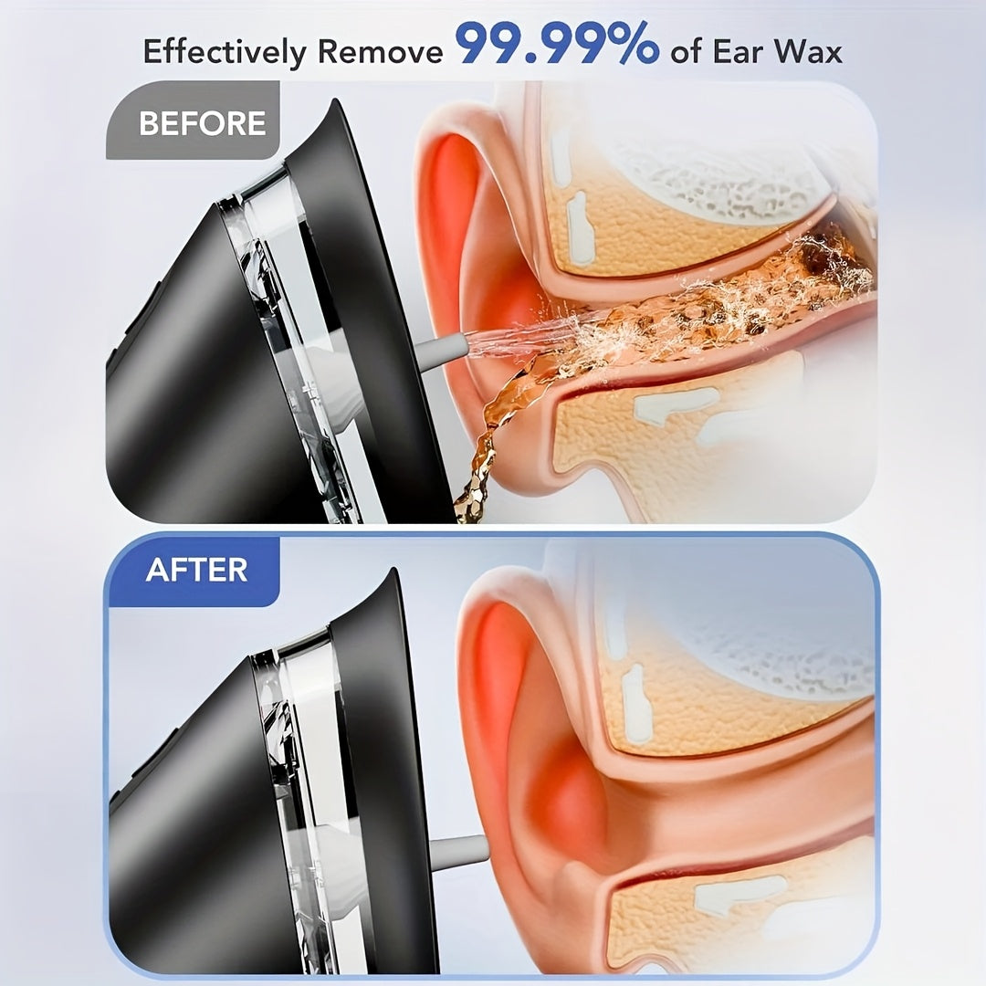 Professional Electric Ear Wax Cleaner with Three Speed Water Pressure and Rechargeable Battery