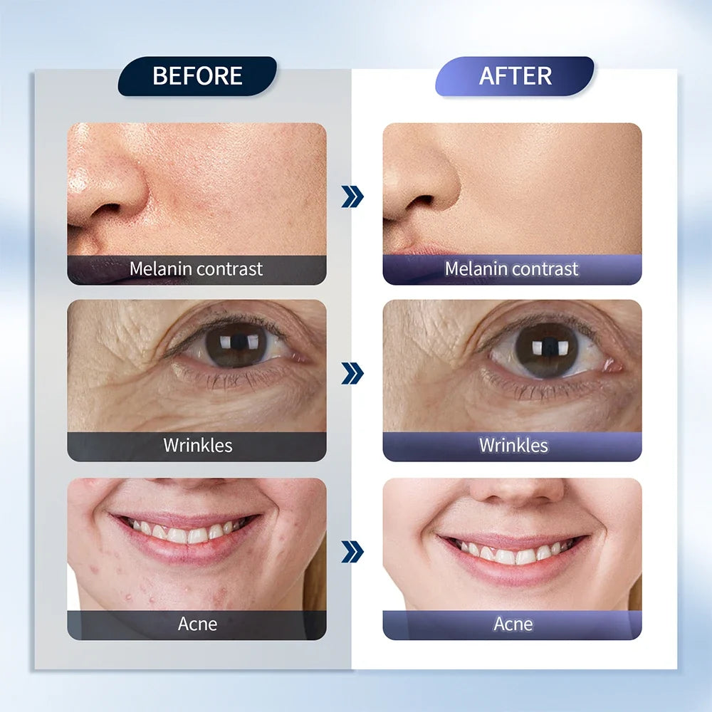 7-Color LED Photon Face Mask & Nano Spray Machine - Skin Rejuvenation Anti-Aging Home Therapy