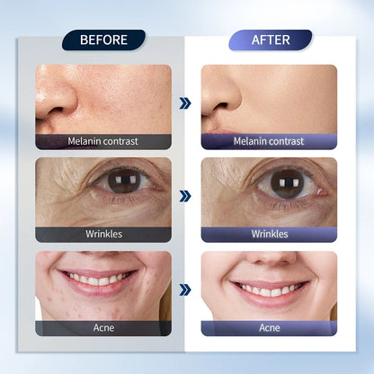 7-Color LED Photon Face Mask & Nano Spray Machine - Skin Rejuvenation Anti-Aging Home Therapy