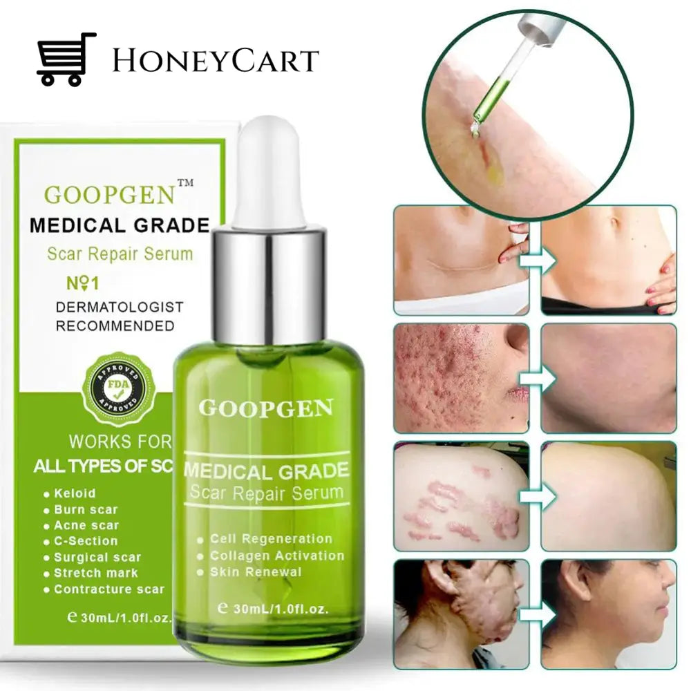 Advanced Scar Repair Serum For All Types Of Scars - Especially Acne Surgical And Stretch Marks