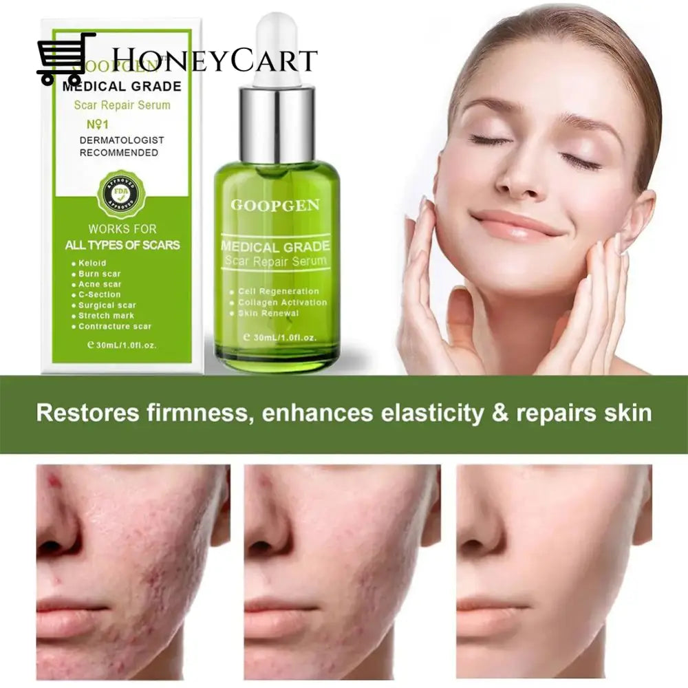 Advanced Scar Repair Serum For All Types Of Scars - Especially Acne Surgical And Stretch Marks
