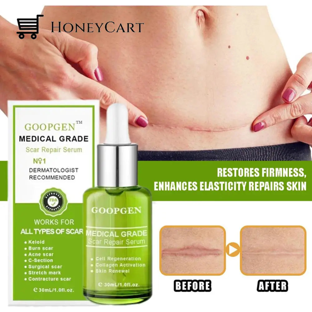 Advanced Scar Repair Serum For All Types Of Scars - Especially Acne Surgical And Stretch Marks