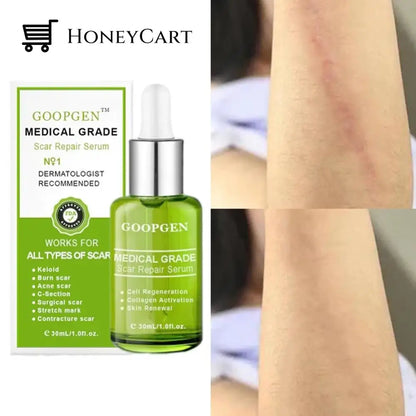 Advanced Scar Repair Serum For All Types Of Scars - Especially Acne Surgical And Stretch Marks