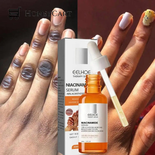 Advanced Skin Brightening Serum For Melanosis Dark Spot Removal