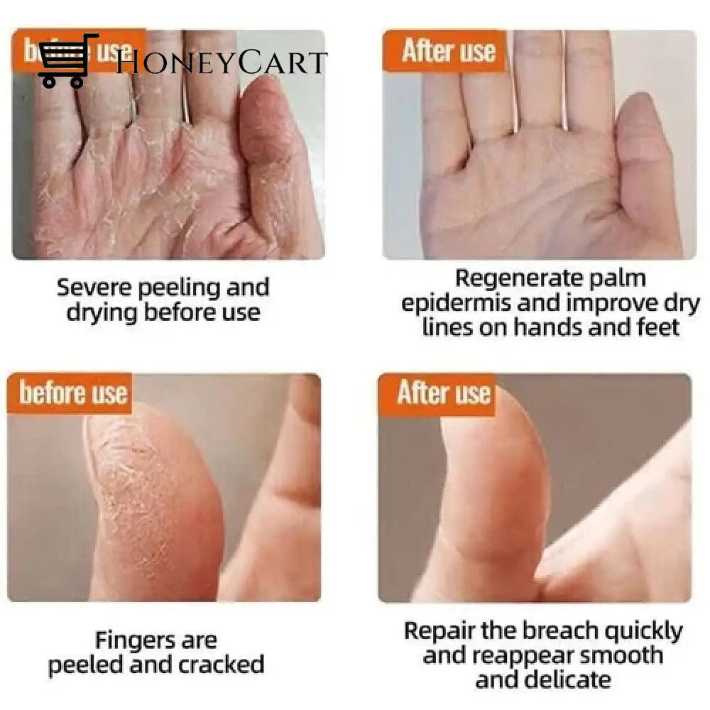 Anti Cracking Frost Tool