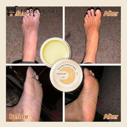 Anti Cracking Frost Tool