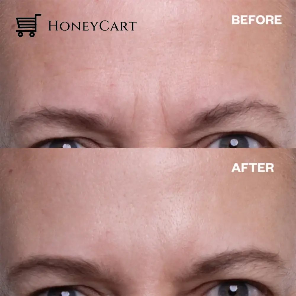 Anti-Wrinkle Reusable Silicone Patches Face