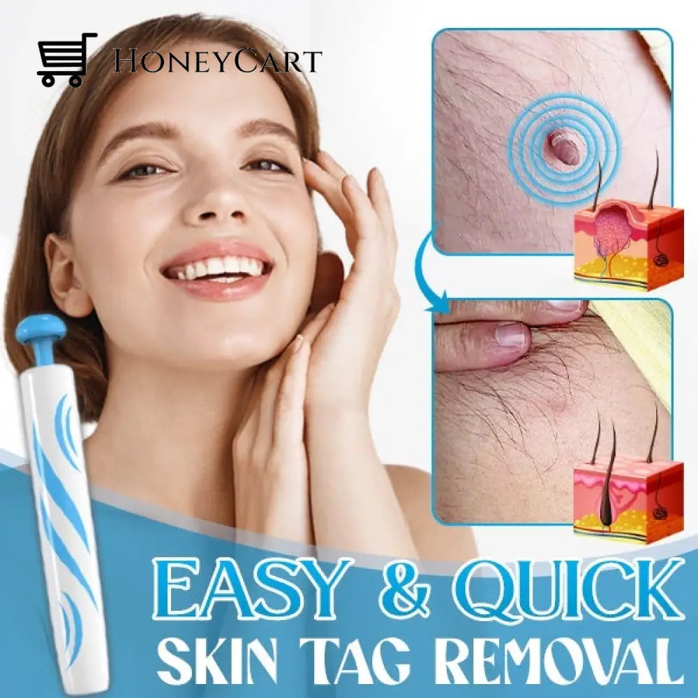 Auto-Micro Skin Tag Remover