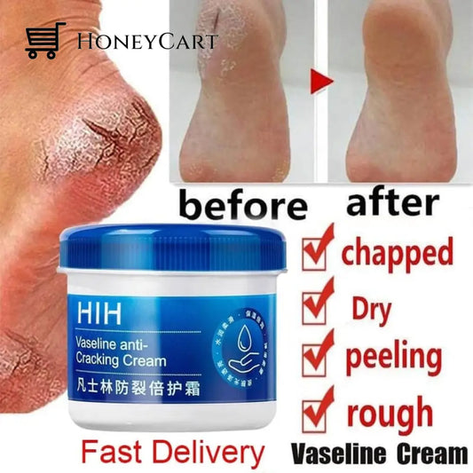 Foot Cream Vaseline Anti-Cracking Moisturizing And Hand Beauty