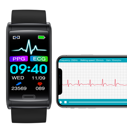 ECG Bracelet Blood Oxygen Blood Glucose Scientific Sleep HRV Smart Watch