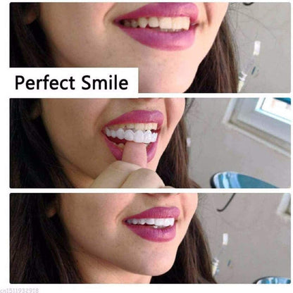 Teeth veneers Instant Cosmetic Veneers (Upper & Lower)