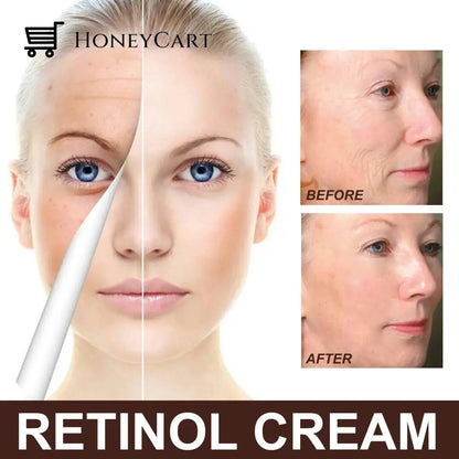 Retinol Anti Aging Wrinkle Remove Skin Firming Cream