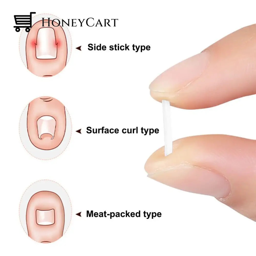 Toe Nail Support Pad Care