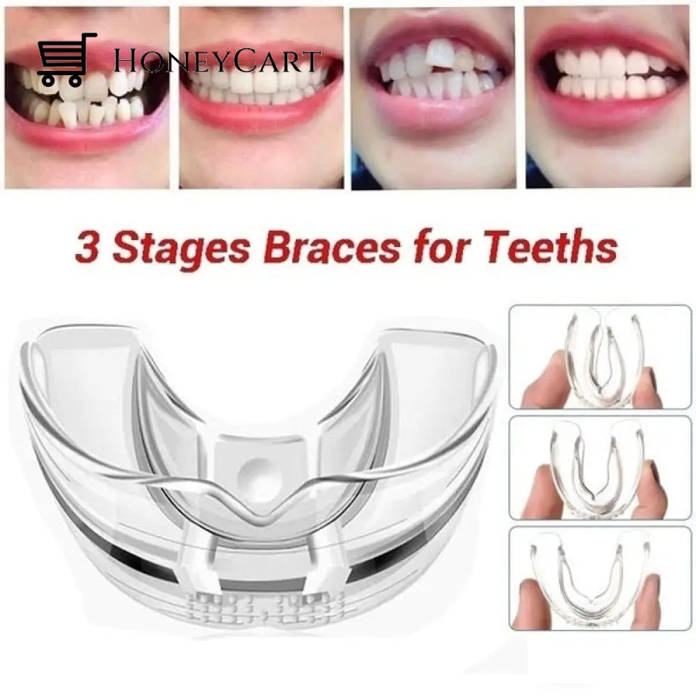 Tooth Orthodontic Braces