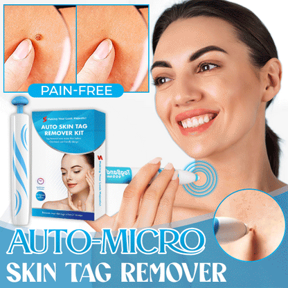Auto-Micro Skin Tag Remover