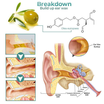 GFOUK™ Anti Cochlear Blockage Removal Spray